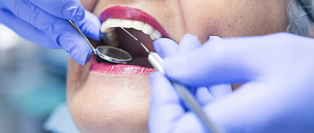 Best Emergency Root Canal Therapy in Kingston, NY